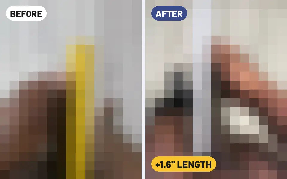 Andre P. before and after photo with an Epic device, +1.6 inches length (blurred preview)