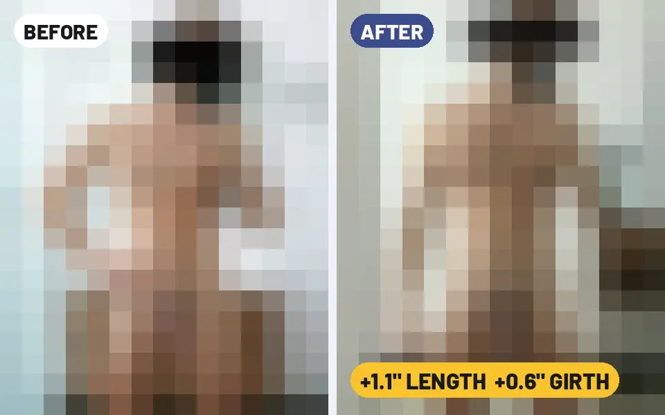Diego F. Castillo penis extender before and after photo, +1.1 inches length and +0.6 inches girth (blurred preview)