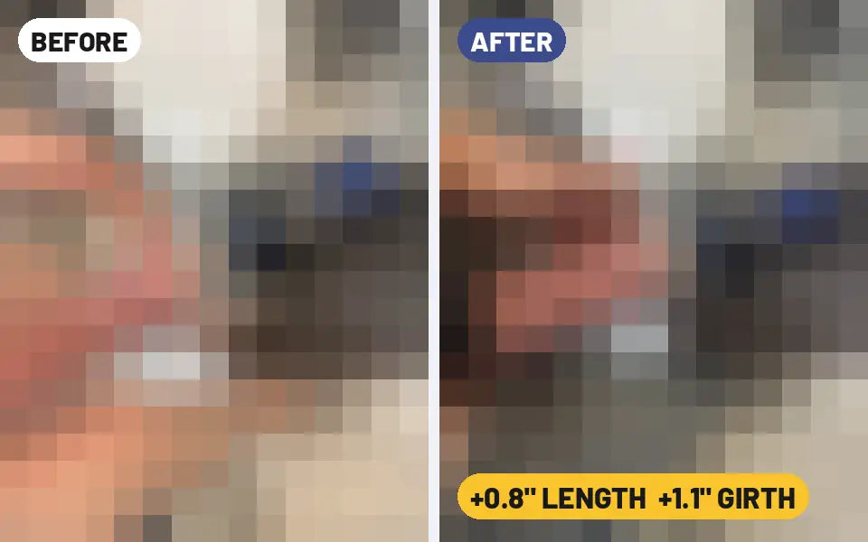 Tyler A. Brennan penis extender before and after photo, +0.8 inches length and +1.1 inches girth, 8 weeks (blurred preview)